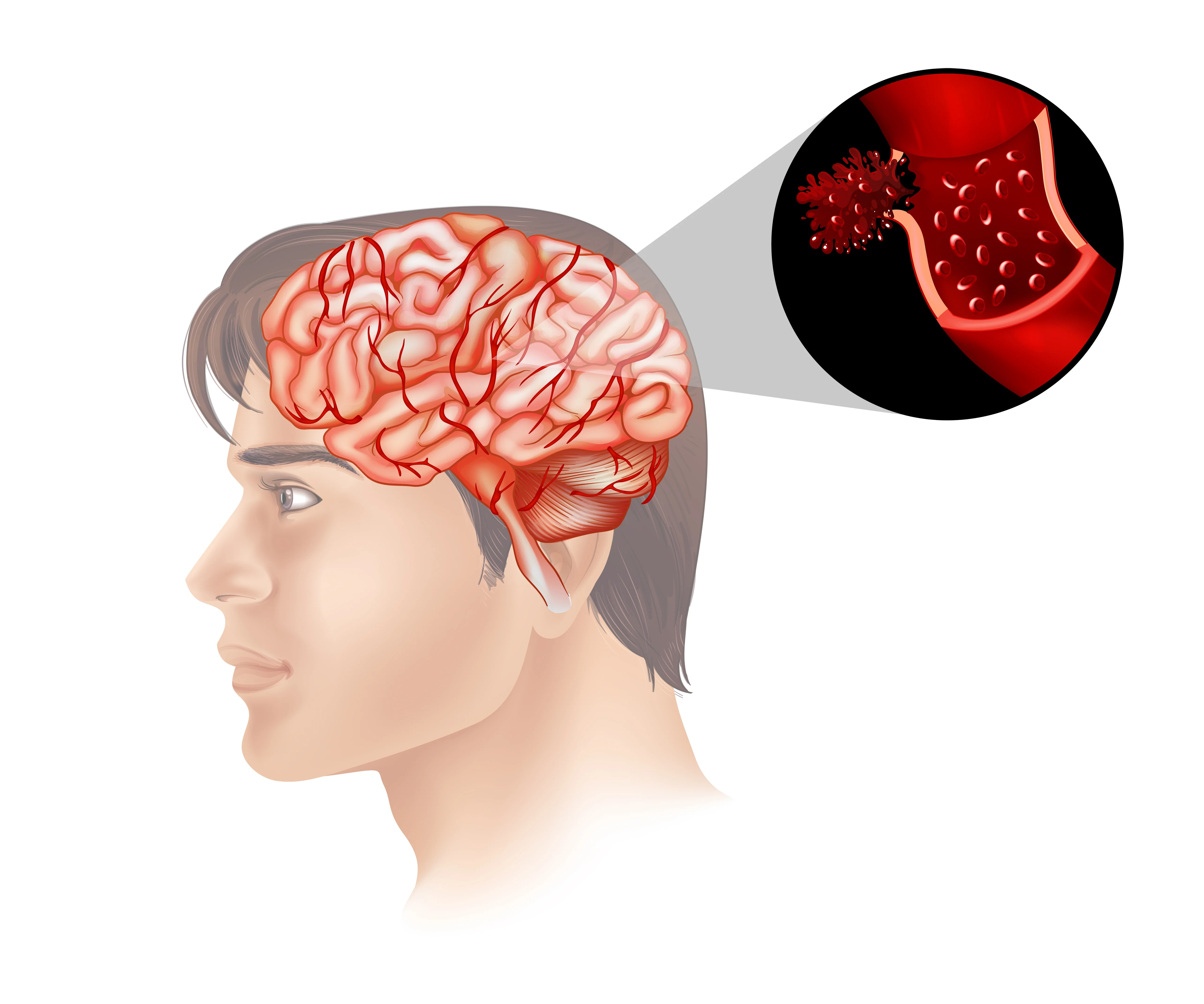 Brain Tumor, Infection, Vascular Malformation, and Congenital Disorders